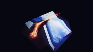 default video 1000x562 img