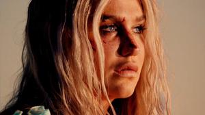 default video 1000x562 img