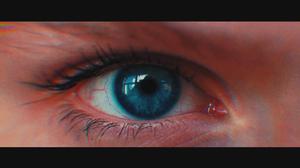 default video 1000x562 img